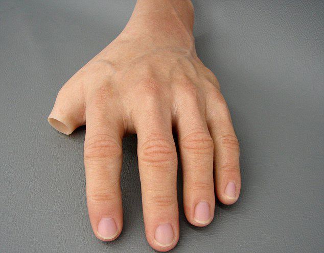 手指假肢價(jià)格安裝假肢需要花費(fèi)多少錢(qián)(圖1) 手指假肢價(jià)格安裝假肢需要花費(fèi)多少錢(qián)(圖1)