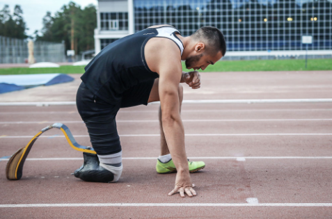 假肢價格需要注重嗎?(圖1) 假肢價格需要注重嗎?