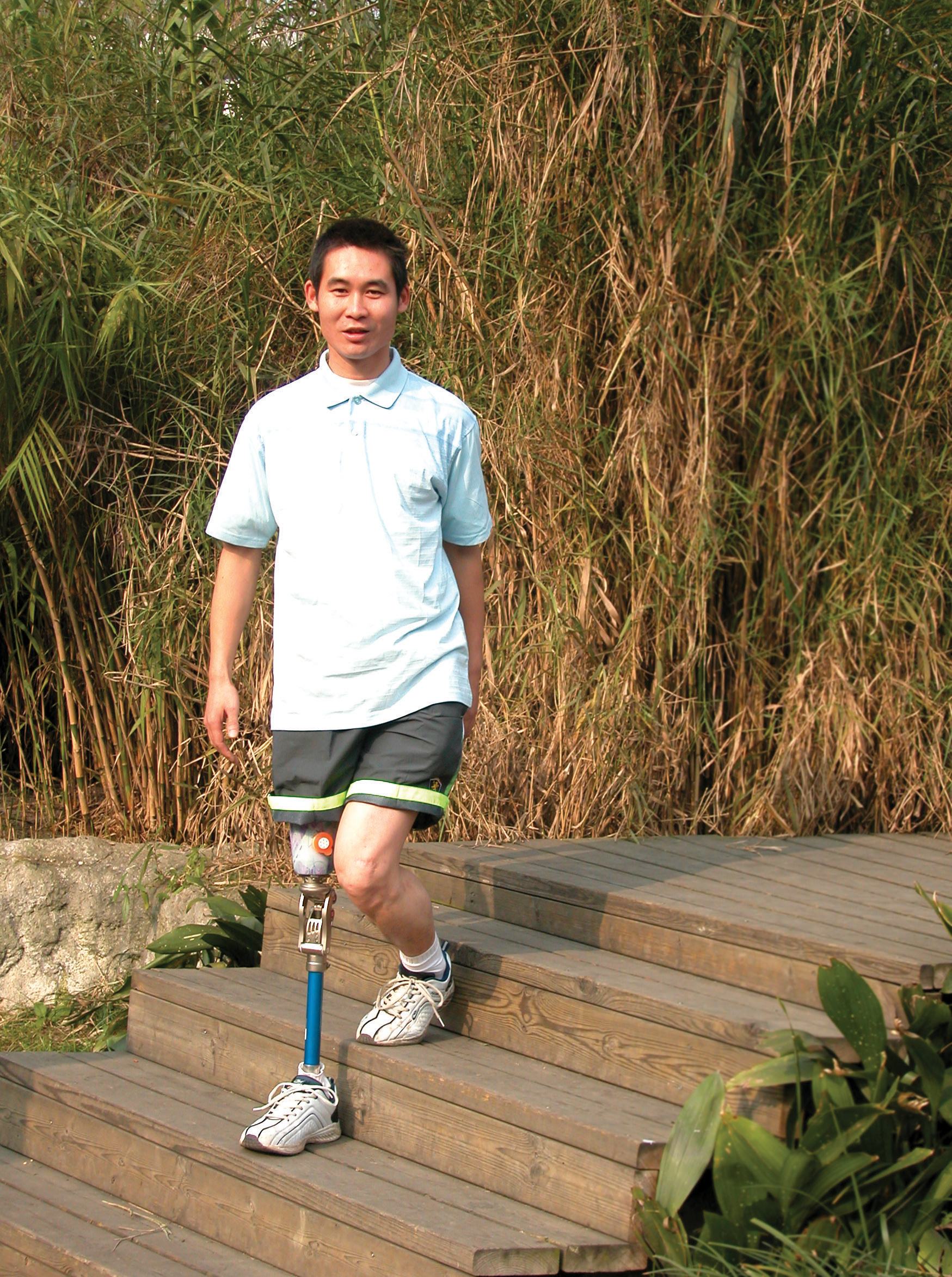 假肢價格廠家?guī)湍破占僦R(圖1) 假肢價格廠家?guī)湍破占僦R